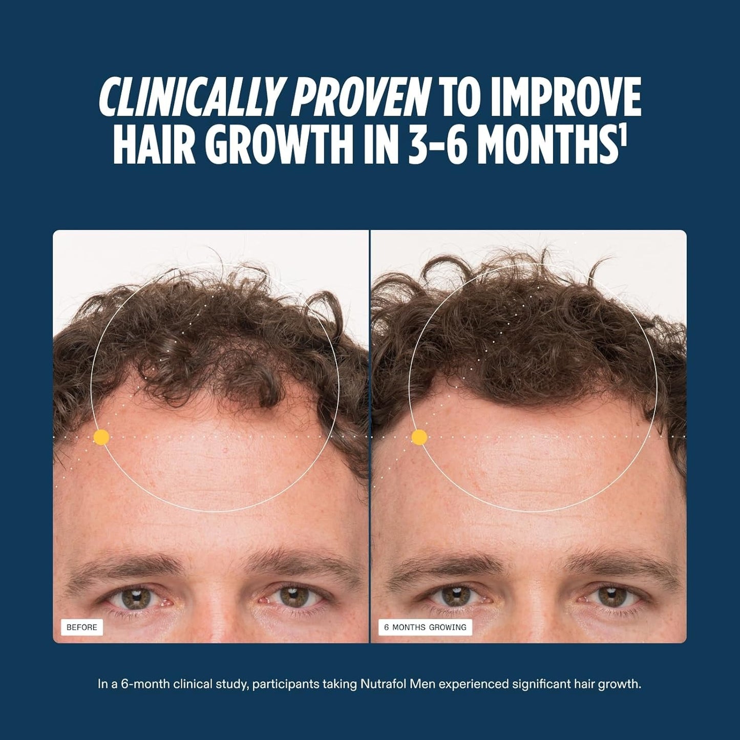 Nutrafol Men Hair Wellness Capsules – Clinically Tested Hair Support