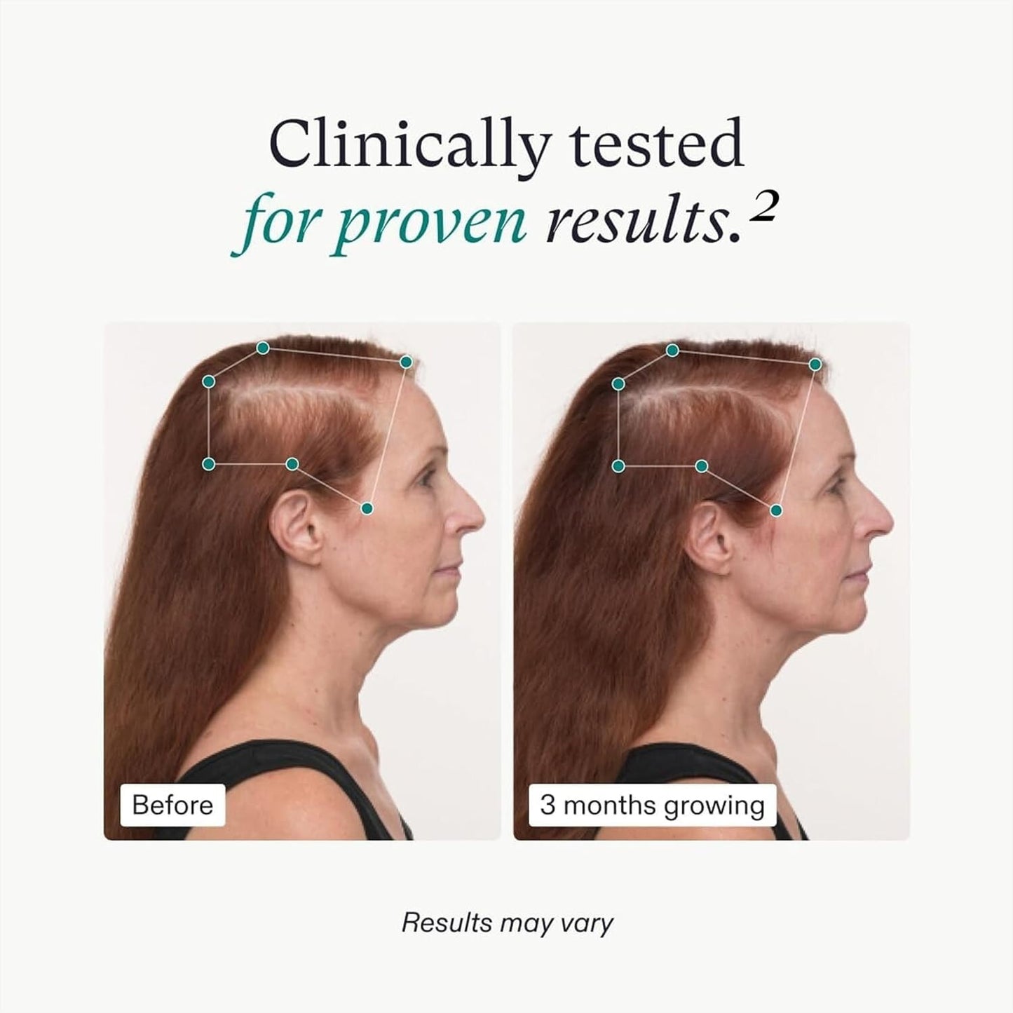 Nutrafol Women's Balance Hair Growth Capsules for Women Aged 45 and Over